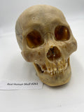 A Real Uncut Human Skull With Uncut Calvarium #261