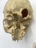 Antique Real Human Skull #271