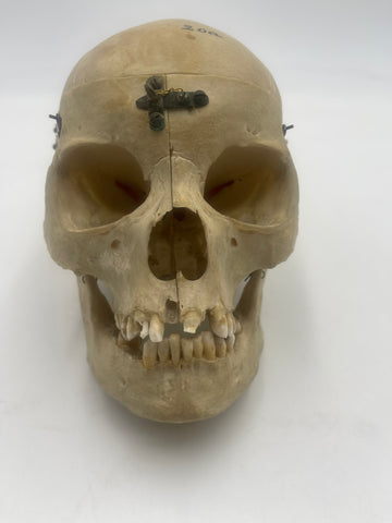 Antique Real Human Skull #271