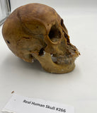 A Real Uncut Human Skull With Metopic Suture #266