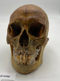 A Real Uncut Human Skull With Metopic Suture #266
