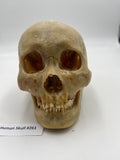 A Real Uncut Human Skull With Uncut Calvarium #261