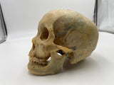 A Real Uncut Human Skull With Uncut Calvarium #261