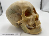 A Real Uncut Human Skull With Uncut Calvarium #261