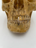 A Vintage Real Human Dissected Skull 566