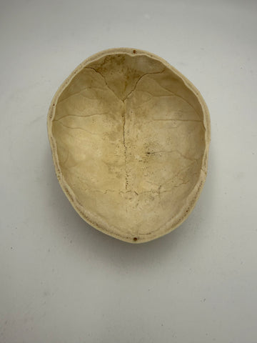 A Real Human Skull Cap 2