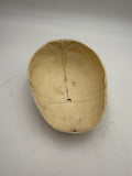A Real Human Skull Cap 3
