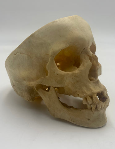 A Real Human Skull without Calvarium #286