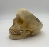 A Real Human Skull without Calvarium #286