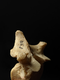 Five Thoracic Human Vertebrae Set