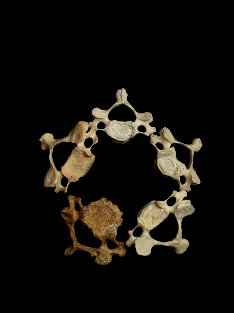 5x Cervical Vertebrae Set