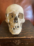 Antique Human Skull With Possible Pathology / Trauma and Antique Case
