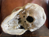 Antique Human Skull With Possible Pathology / Trauma and Antique Case