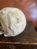 Antique Human Skull With Possible Pathology / Trauma and Antique Case