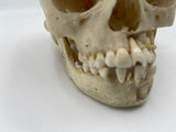 A Very Nice Real Human Pediatric Skull With Dissected Jaw 303