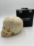 A Very Nice Real Human Pediatric Skull With Dissected Jaw 303