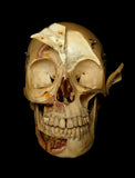 Dissected Human Skull