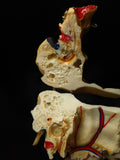 Dissected Human Skull