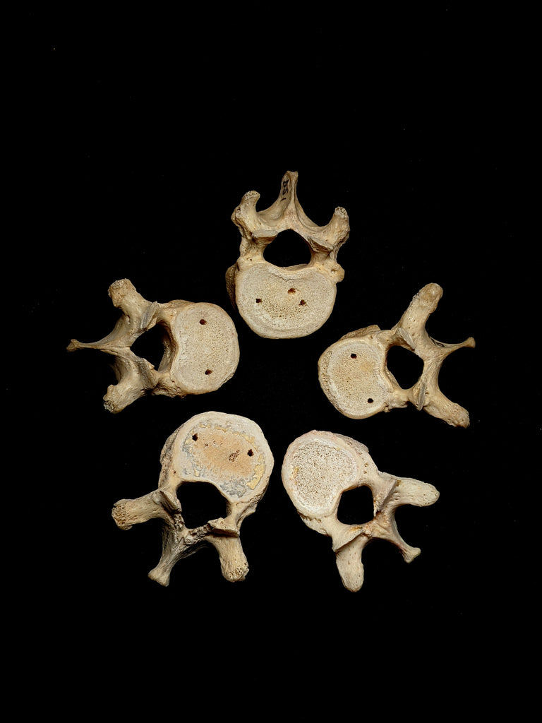 Five Thoracic Human Vertebrae Set