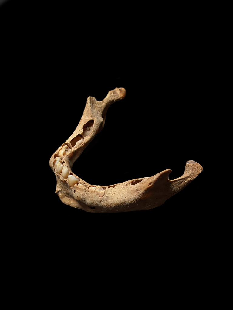 Pediatric Human Mandible