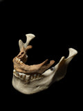 Pediatric Human Mandible