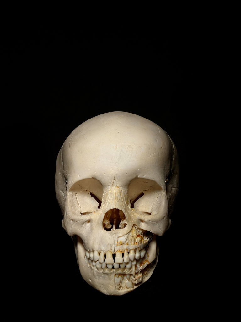 Young Pediatric Human Skull With Exposed Dentitions