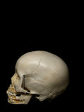 Young Pediatric Human Skull With Exposed Dentitions