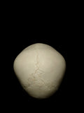 Young Pediatric Human Skull With Exposed Dentitions