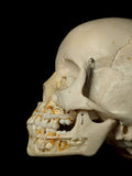 Young Pediatric Human Skull With Exposed Dentitions