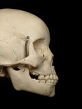 Young Pediatric Human Skull With Exposed Dentitions