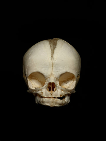 30 Week Old Human Fetal Skull