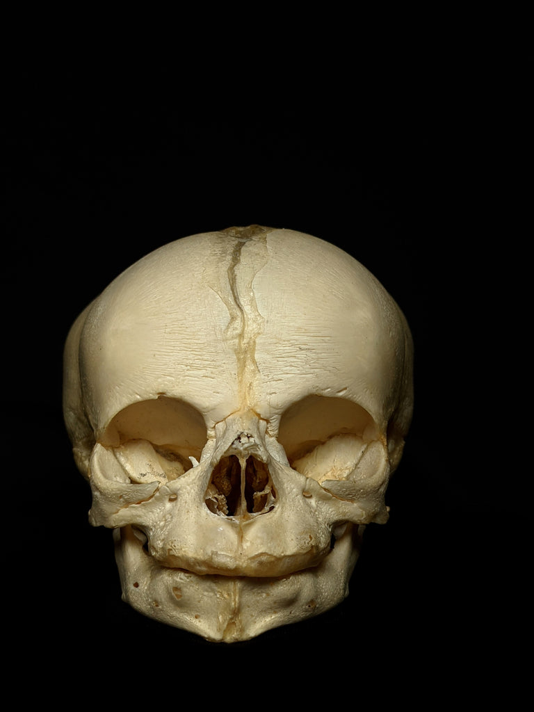 40 Week Old Human Fetal Skull