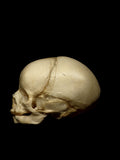 40 Week Old Human Fetal Skull