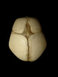 40 Week Old Human Fetal Skull