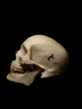 Carolina Biological Human Skull With Foramen Infection