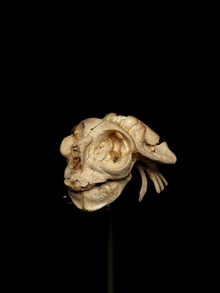 Pathology Anencephaly Fetal Human Skull