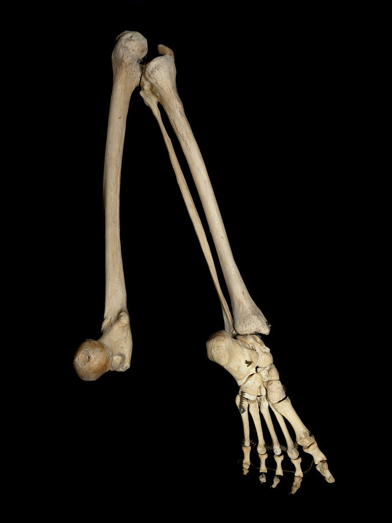 Antique Articulated Human Leg