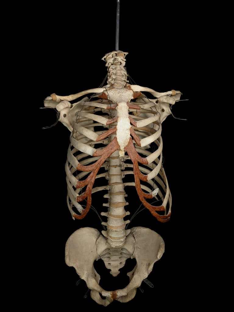 Adult Articulated Human Torso With Spina Bifida Occulta