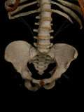 Adult Articulated Human Torso With Spina Bifida Occulta