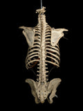 Adult Articulated Human Torso With Spina Bifida Occulta