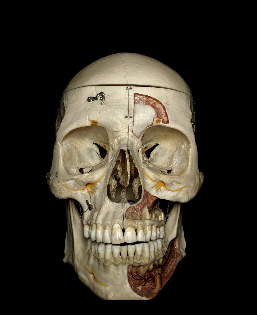 H.G Demonstration Human Skull With Metopic Suture